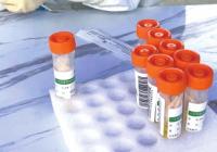 第三方检测机构谋发展别动歪脑筋 努力创新才是可行之计