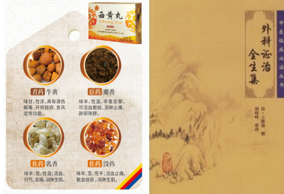 传承经典，名家组方——西黄丸的临床应用