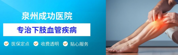 泉州成功医院：养护静脉曲张，远离老烂腿困扰
