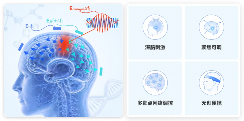 瑞尔唯康TI时间干涉设备赋能脑神经调控诊疗