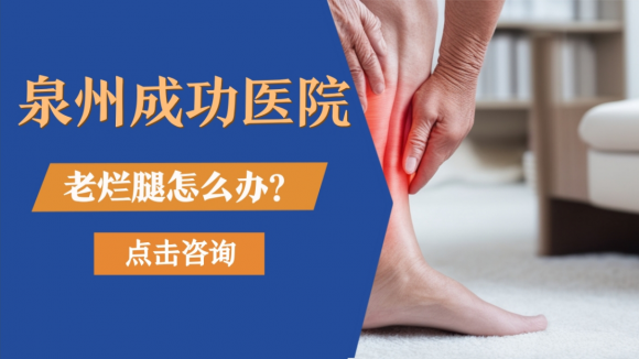 泉州成功医院｜深耕泉州三十余年，专注改善静脉曲张、老烂腿各类不适