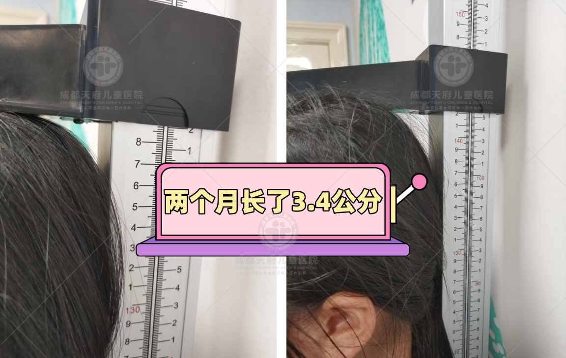 两月长高3.4厘米！成都天府儿童医院张敏主任：科学助力儿童稳步生长