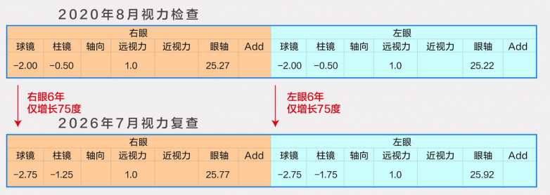 16岁男孩佩戴OK镜6年，近视度数仅增75度！钱朝旭主任：遗传性近视也能踩下“刹车”