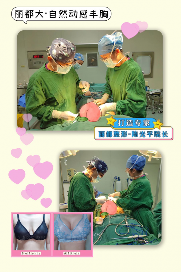 无锡丽都做丰胸效果好吗？蜜桃胸打造贴合身形饱满体态