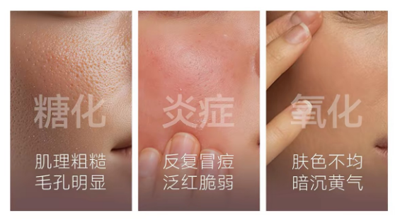 年轻人的脸，正在被「糖、氧、炎」反复拉扯？ 晓姿AG焕颜抗糖丸从三条路径回应当代年轻肌肤状态