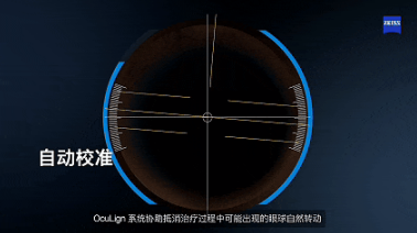 北京茗视光眼科中秋国庆摘镜攻略，选对术式安心变清晰